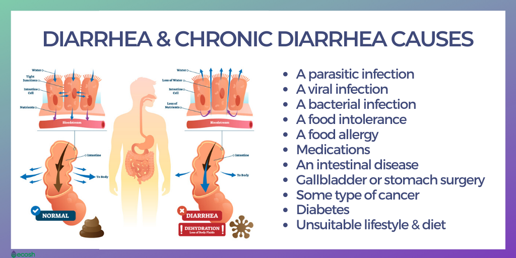 Diarrhea Symptoms And Treatment Options Ask The Nurse Expert Diarrhea Symptoms And Treatment Options Ask The Nurse Expert