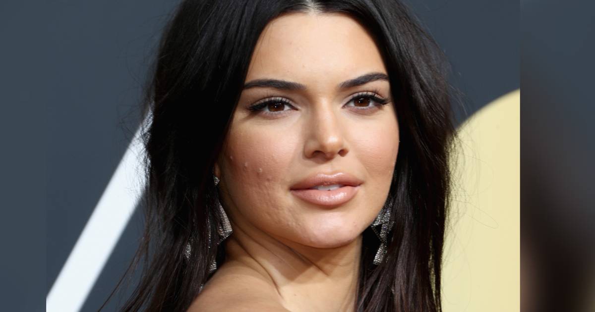 Kendall Jenner Addresses Golden Globes Acne Amp 39 Never Let That Sh T Stop You Amp 39